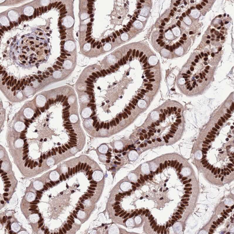 ARS2 Antibody - BSA Free Immunohistochemistry: ARS2 Antibody - BSA Free [NBP2-13382]