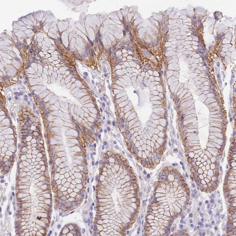 SRrp35 Antibody - BSA Free Immunohistochemistry: SRrp35 Antibody - BSA Free [NBP2-13383]