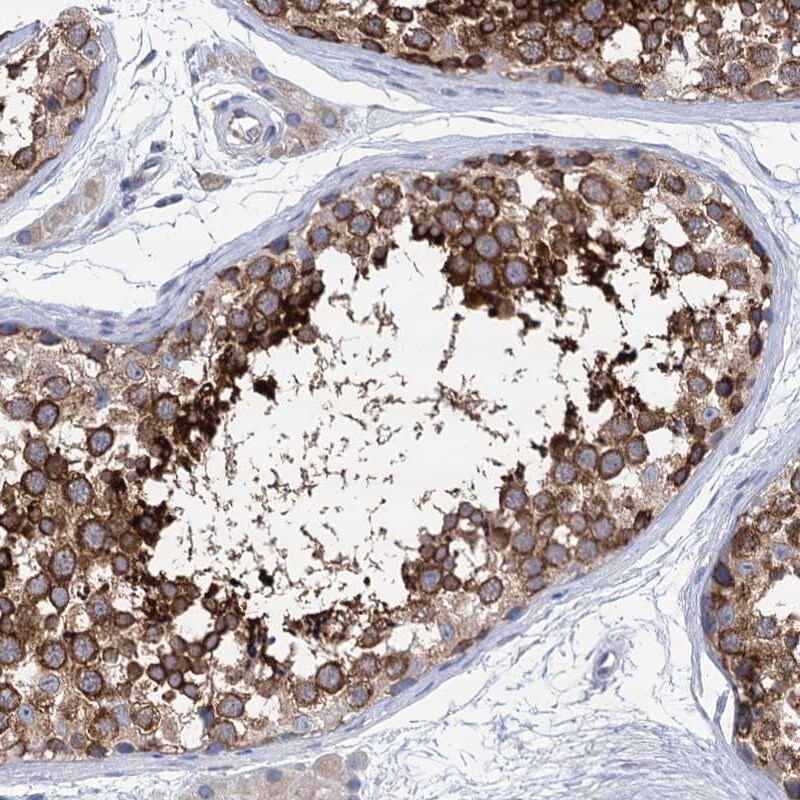 SSSCA1 Antibody - BSA Free Immunohistochemistry-Paraffin: SSSCA1 Antibody [NBP2-13387]
