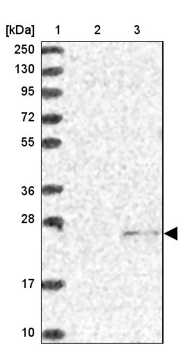 SSSCA1 Antibody - BSA Free Western Blot: SSSCA1 Antibody - BSA Free [NBP2-13387]