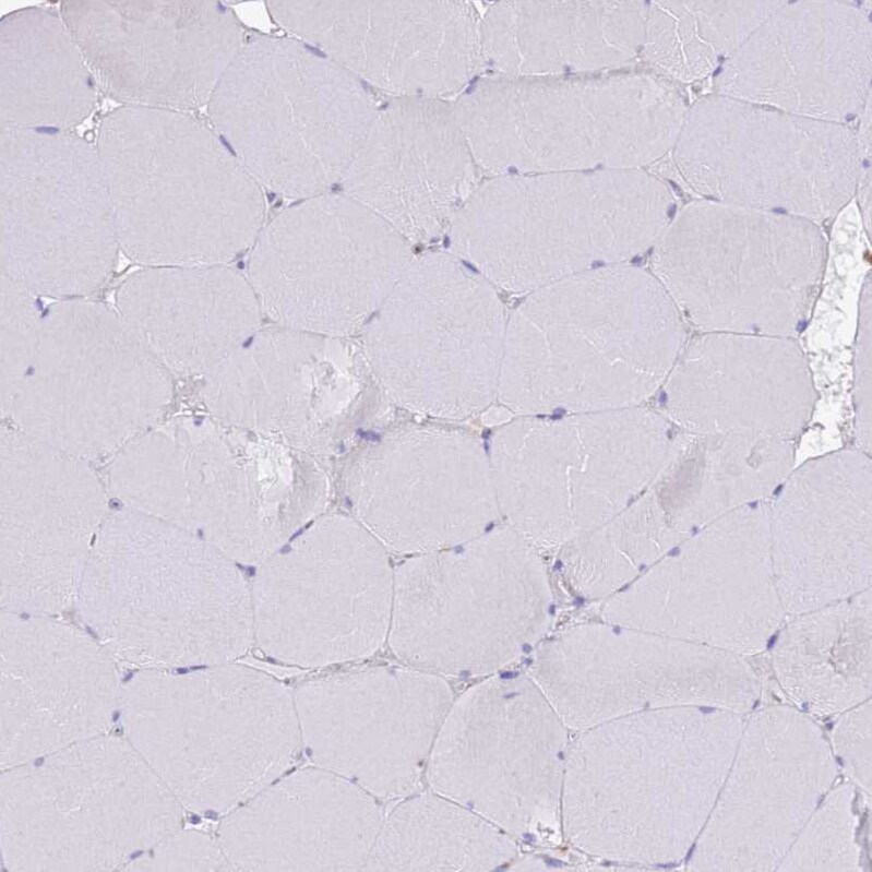 ST3GAL4 Antibody - BSA Free Immunohistochemistry: ST3GAL4 Antibody - BSA Free [NBP2-13390]