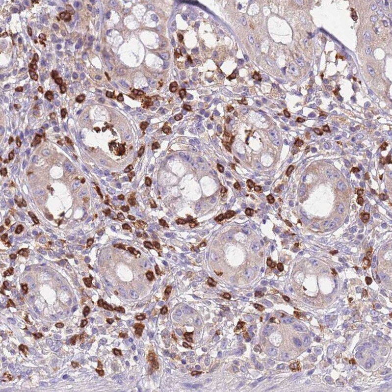 ST3GAL4 Antibody - BSA Free Immunohistochemistry: ST3GAL4 Antibody - BSA Free [NBP2-13390]