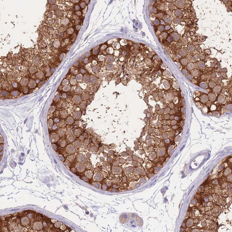 ST3GAL4 Antibody - BSA Free Immunohistochemistry: ST3GAL4 Antibody - BSA Free [NBP2-13390]