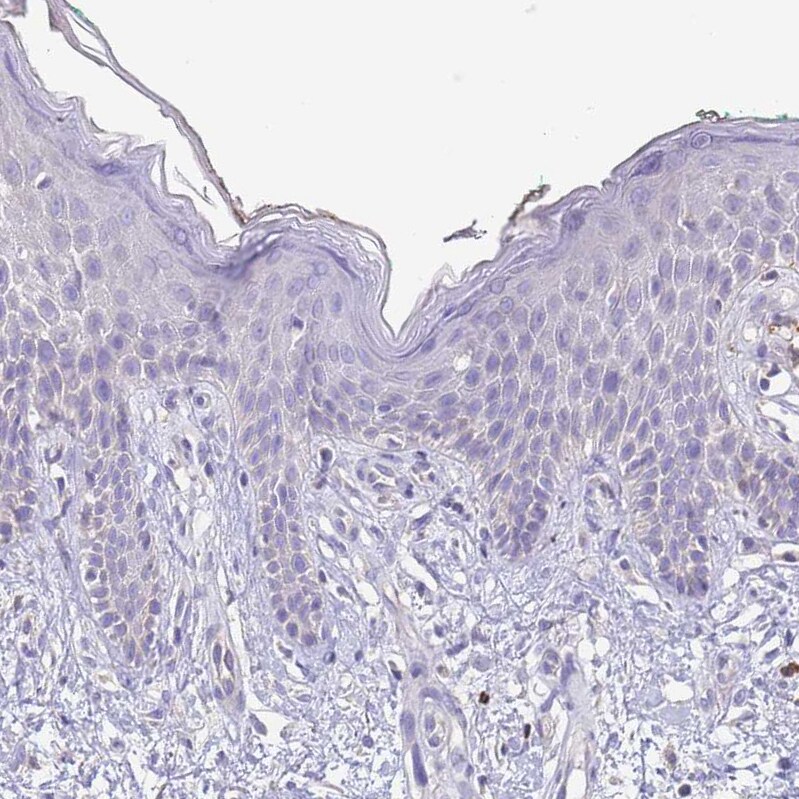 ST3GAL4 Antibody - BSA Free Immunohistochemistry: ST3GAL4 Antibody - BSA Free [NBP2-13390]