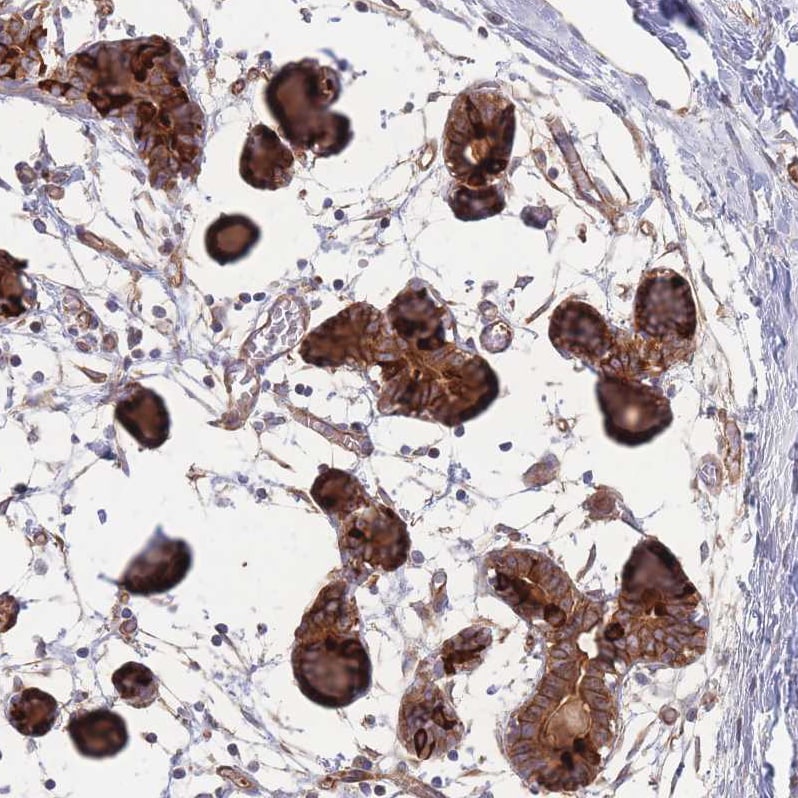 STEAP3/TSAP6 Antibody - BSA Free Immunohistochemistry: STEAP3/TSAP6 Antibody - BSA Free [NBP2-13395]
