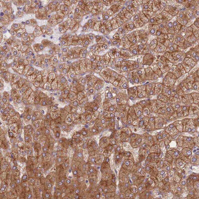 STEAP3/TSAP6 Antibody - BSA Free Immunohistochemistry: STEAP3/TSAP6 Antibody - BSA Free [NBP2-13395]