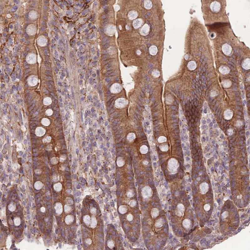 STEAP3/TSAP6 Antibody - BSA Free Immunohistochemistry: STEAP3/TSAP6 Antibody - BSA Free [NBP2-13395]