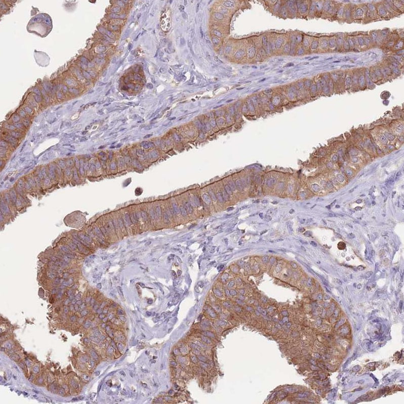 STEAP3/TSAP6 Antibody - BSA Free Immunohistochemistry: STEAP3/TSAP6 Antibody - BSA Free [NBP2-13395]