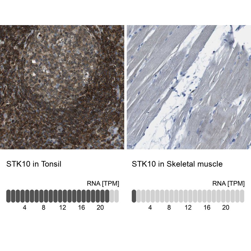 LOK Antibody - BSA Free Immunohistochemistry: LOK Antibody - BSA Free [NBP2-13396]