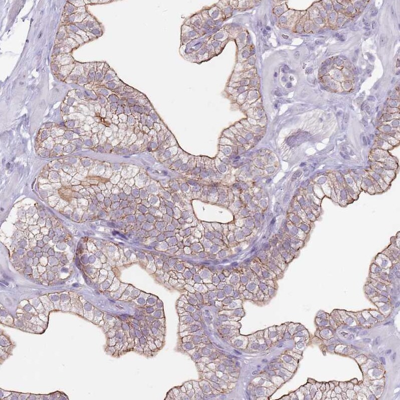 STYK1 Antibody - BSA Free Immunohistochemistry: STYK1 Antibody - BSA Free [NBP2-13398]