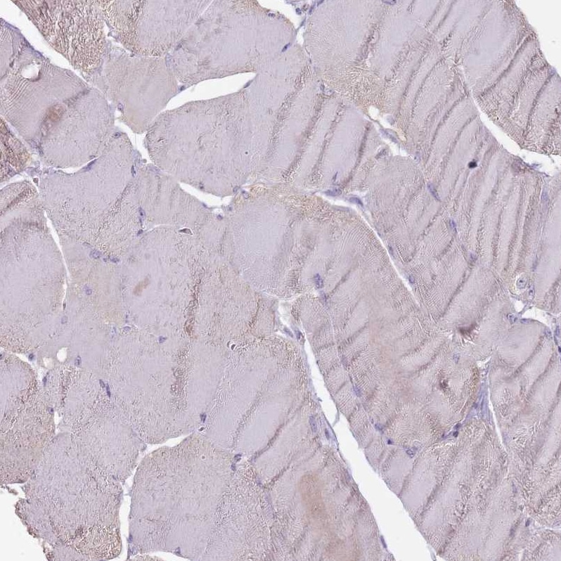 STYK1 Antibody - BSA Free Immunohistochemistry: STYK1 Antibody - BSA Free [NBP2-13398]