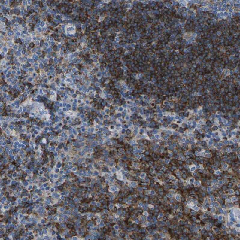Synaptogyrin 2 Antibody - BSA Free Immunohistochemistry: Synaptogyrin 2 Antibody - BSA Free [NBP2-13403]