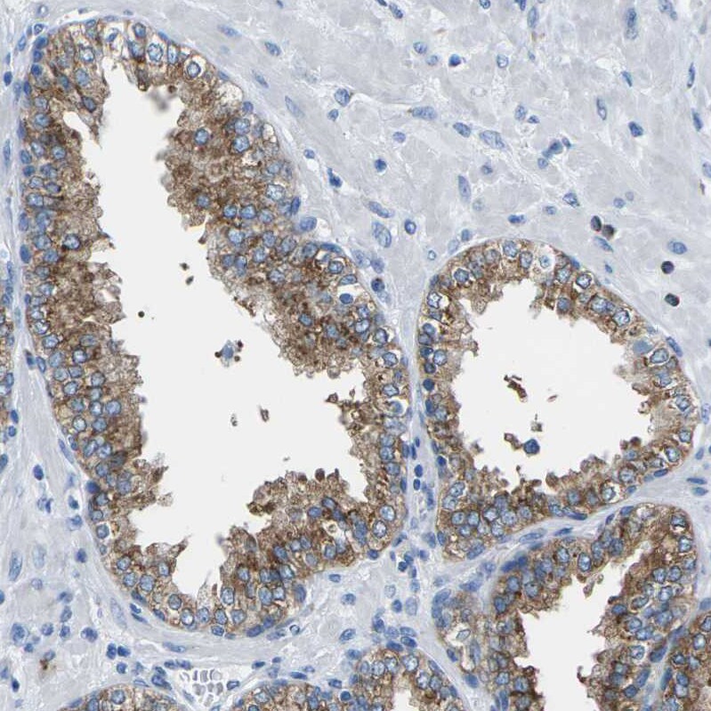 Synaptogyrin 2 Antibody - BSA Free Immunohistochemistry: Synaptogyrin 2 Antibody - BSA Free [NBP2-13403]