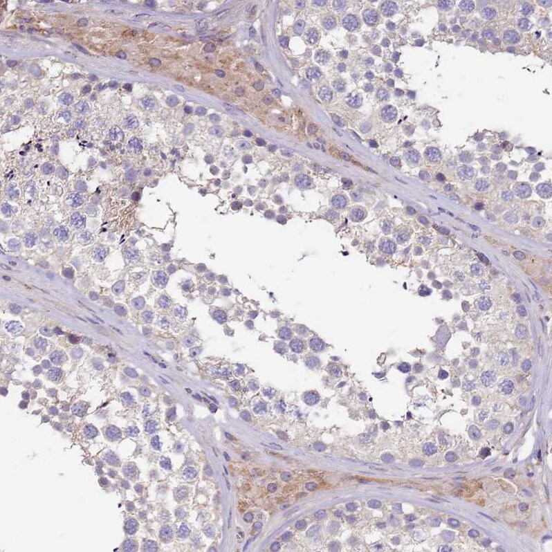 Synaptotagmin 4 Antibody - BSA Free Immunohistochemistry: Synaptotagmin 4 Antibody - BSA Free [NBP2-13408]
