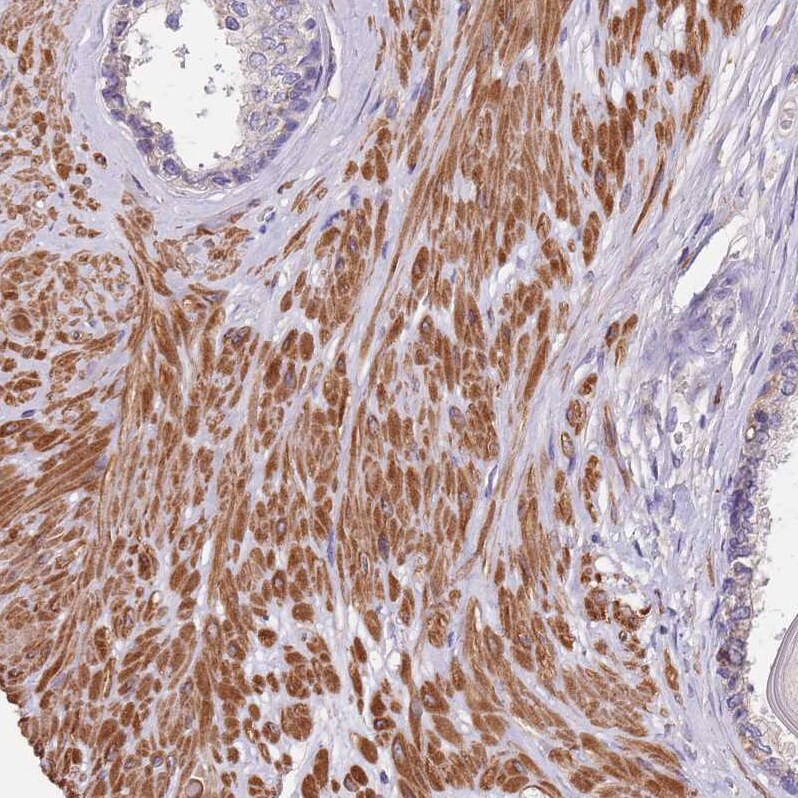 Synaptotagmin 4 Antibody - BSA Free Immunohistochemistry: Synaptotagmin 4 Antibody - BSA Free [NBP2-13408]