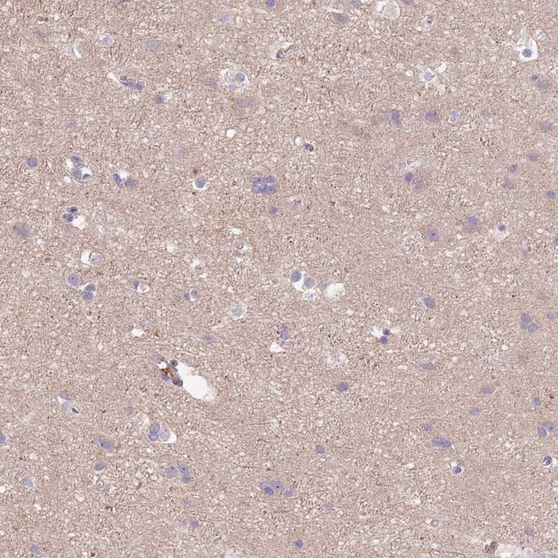 Synaptotagmin 4 Antibody - BSA Free Immunohistochemistry: Synaptotagmin 4 Antibody - BSA Free [NBP2-13408]