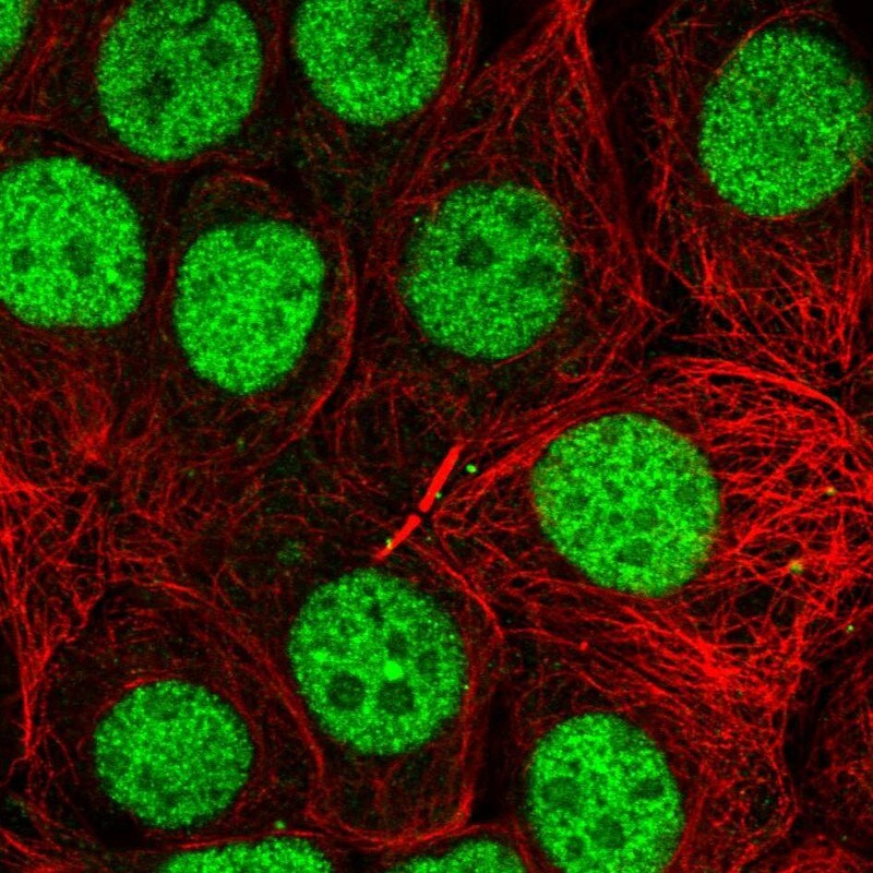 TRBP Antibody - BSA Free Immunocytochemistry/ Immunofluorescence: TRBP Antibody - BSA Free [NBP2-13411]