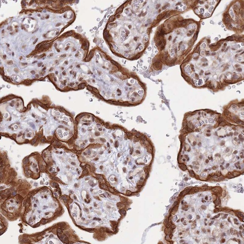 TRBP Antibody - BSA Free Immunohistochemistry: TRBP Antibody - BSA Free [NBP2-13411]