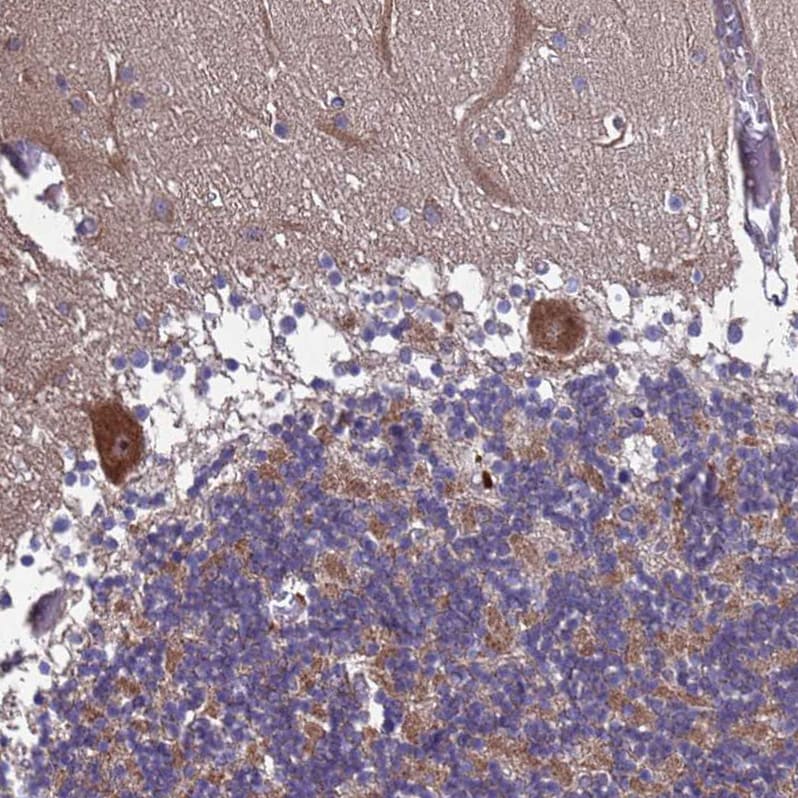 TBK1 Antibody - BSA Free Immunohistochemistry: TBK1 Antibody - BSA Free [NBP2-13416]