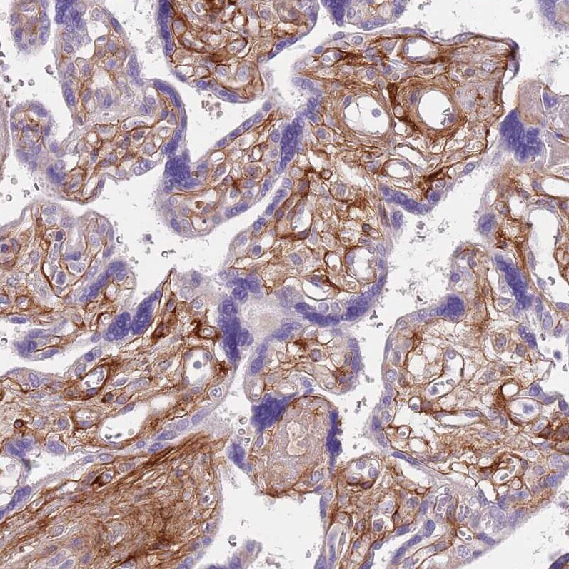 TINAGL1 Antibody - BSA Free Immunohistochemistry: TINAGL1 Antibody - BSA Free [NBP2-13434]