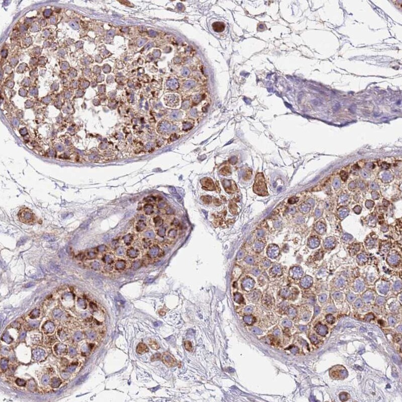 TMEM126A Antibody - BSA Free Immunohistochemistry: TMEM126A Antibody - BSA Free [NBP2-13444]
