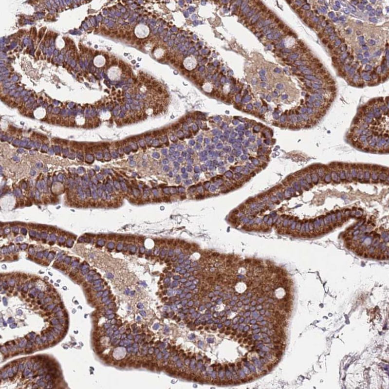 TMEM126A Antibody - BSA Free Immunohistochemistry: TMEM126A Antibody - BSA Free [NBP2-13444]