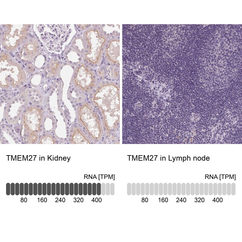 Collectrin/TMEM27 Antibody - BSA Free Immunohistochemistry: Collectrin/TMEM27 Antibody - BSA Free [NBP2-13450]
