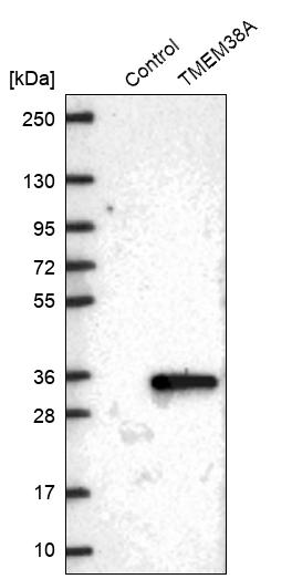 TMEM38A Antibody - BSA Free Western Blot: TMEM38A Antibody - BSA Free [NBP2-13452]