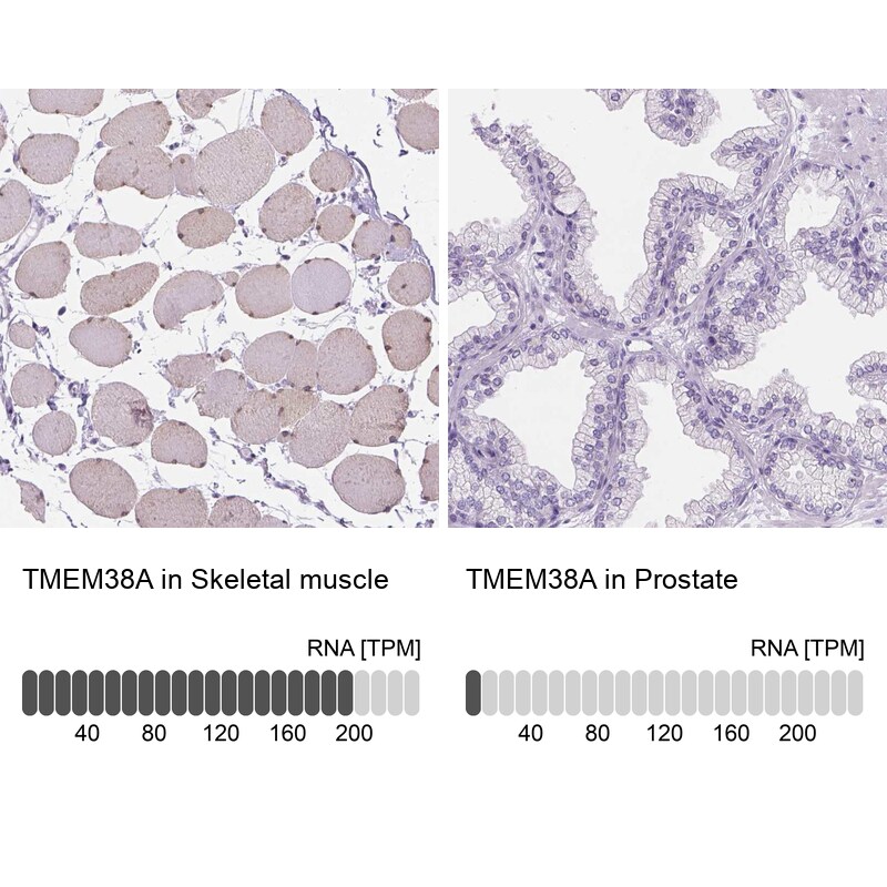 TMEM38A Antibody - BSA Free Immunohistochemistry: TMEM38A Antibody - BSA Free [NBP2-13452]