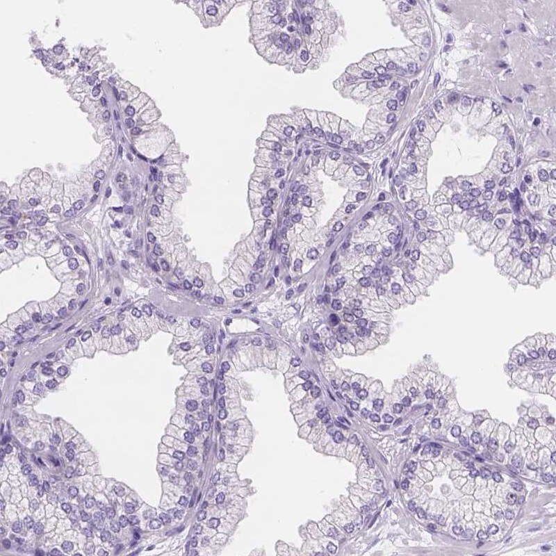 TMEM38A Antibody - BSA Free Immunohistochemistry: TMEM38A Antibody - BSA Free [NBP2-13452]