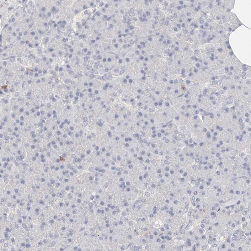 TMEM63B Antibody - BSA Free Immunohistochemistry: TMEM63B Antibody - BSA Free [NBP2-13455]