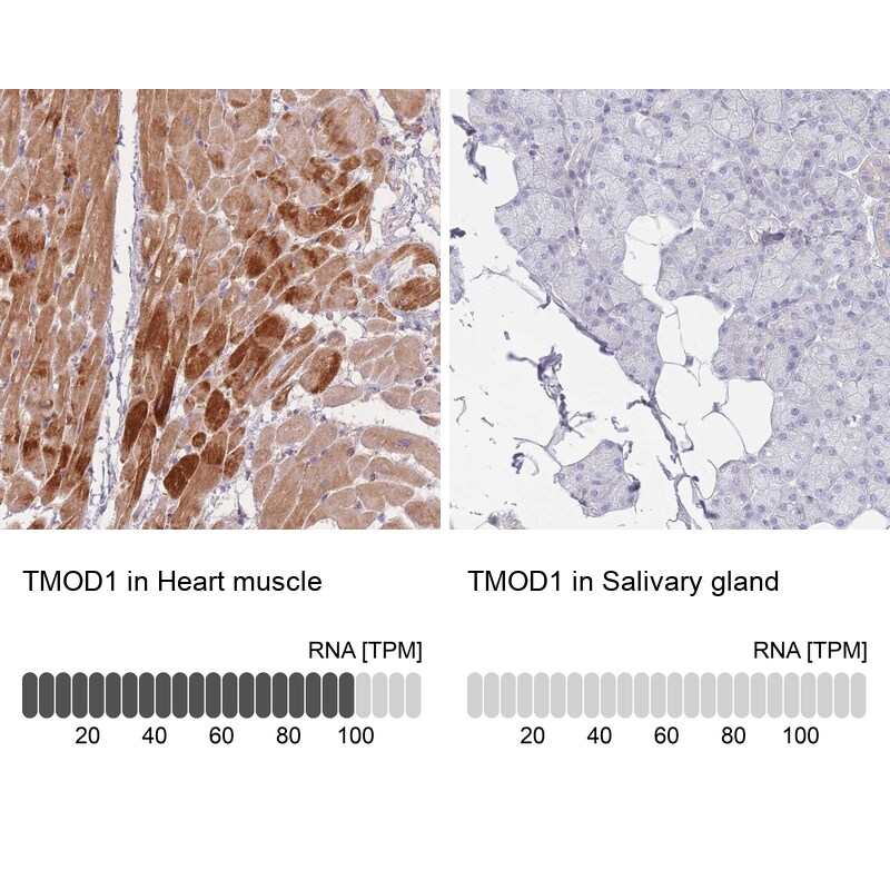 Tropomodulin 1 Antibody - BSA Free Immunohistochemistry: Tropomodulin 1 Antibody - BSA Free [NBP2-13459]