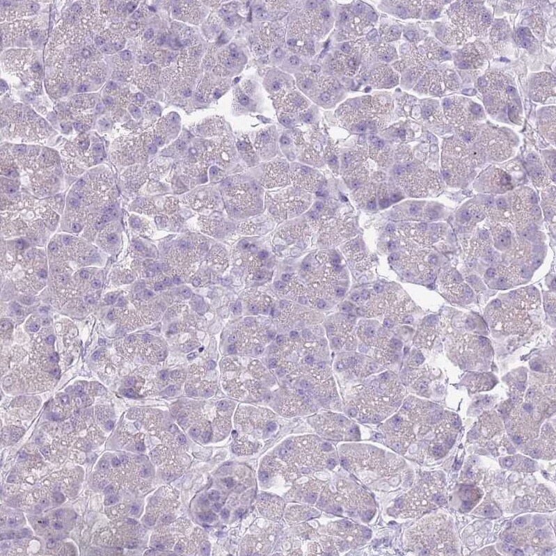 DcR3/TNFRSF6B Antibody - BSA Free Immunohistochemistry: DcR3/TNFRSF6B Antibody - BSA Free [NBP2-13460]