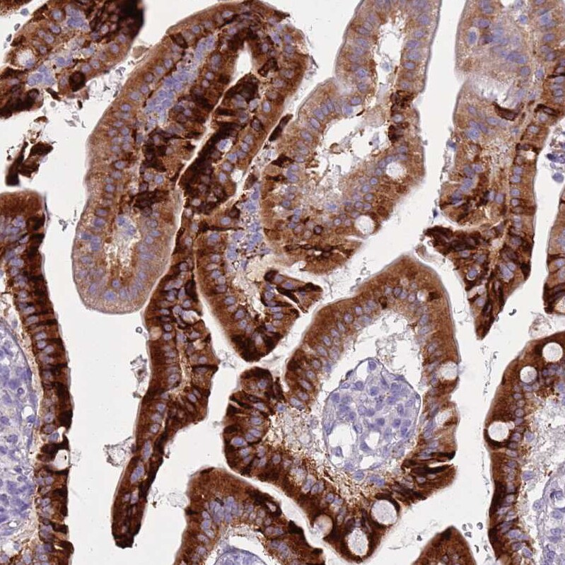 DcR3/TNFRSF6B Antibody - BSA Free Immunohistochemistry: DcR3/TNFRSF6B Antibody - BSA Free [NBP2-13460]