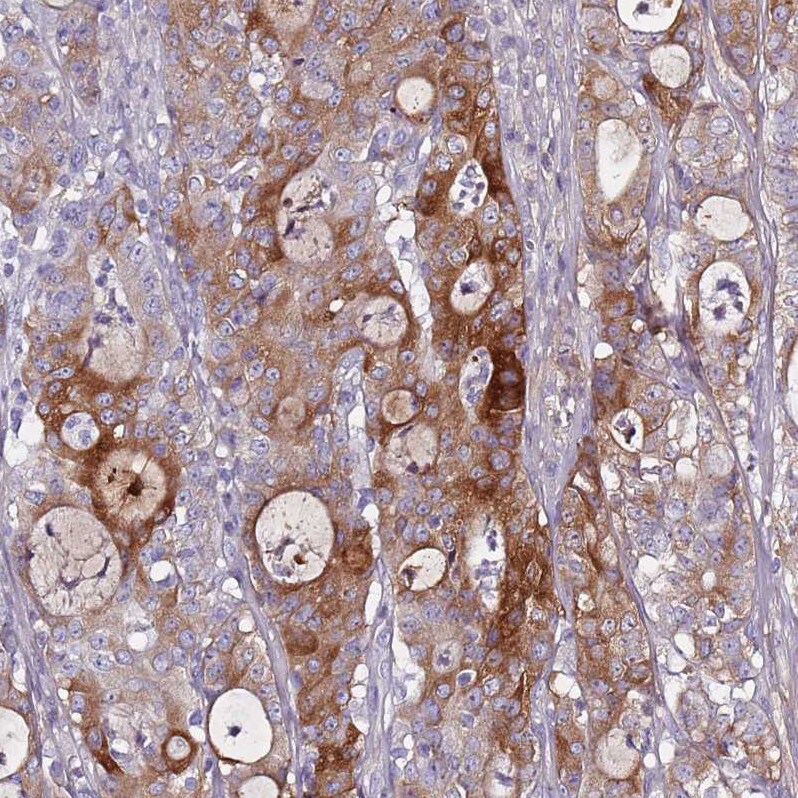DcR3/TNFRSF6B Antibody - BSA Free Immunohistochemistry: DcR3/TNFRSF6B Antibody - BSA Free [NBP2-13460]