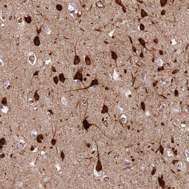 DcR3/TNFRSF6B Antibody - BSA Free Immunohistochemistry: DcR3/TNFRSF6B Antibody - BSA Free [NBP2-13460]