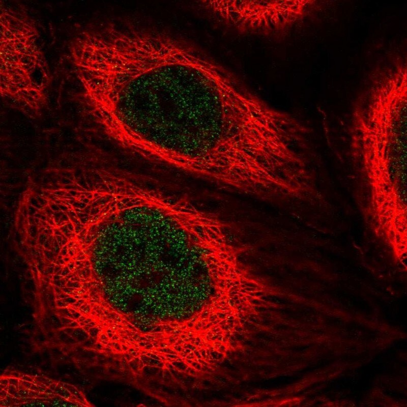 TOX2 Antibody - BSA Free Immunocytochemistry/ Immunofluorescence: TOX2 Antibody - BSA Free [NBP2-13464]
