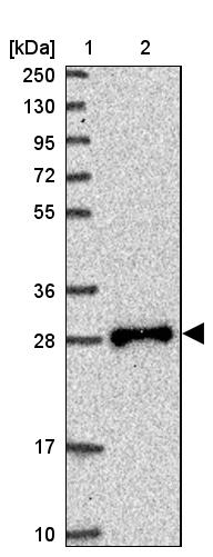 TPD52L2/D54 Antibody - BSA Free Western Blot: TPD52L2/D54 Antibody - BSA Free [NBP2-13468]