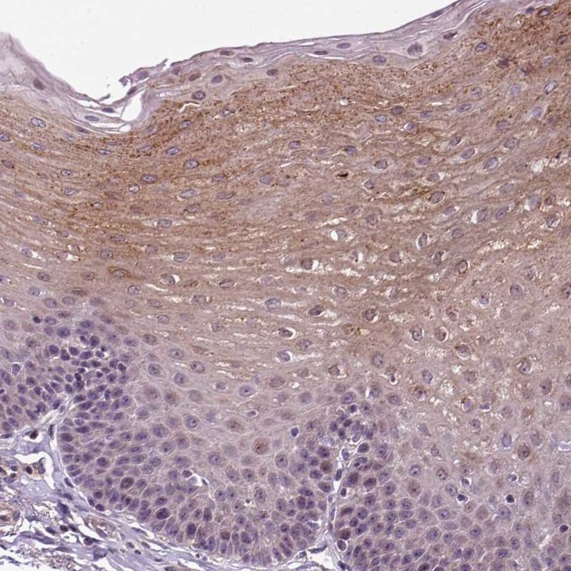 TPRG1 Antibody - BSA Free Immunohistochemistry: TPRG1 Antibody - BSA Free [NBP2-13471]
