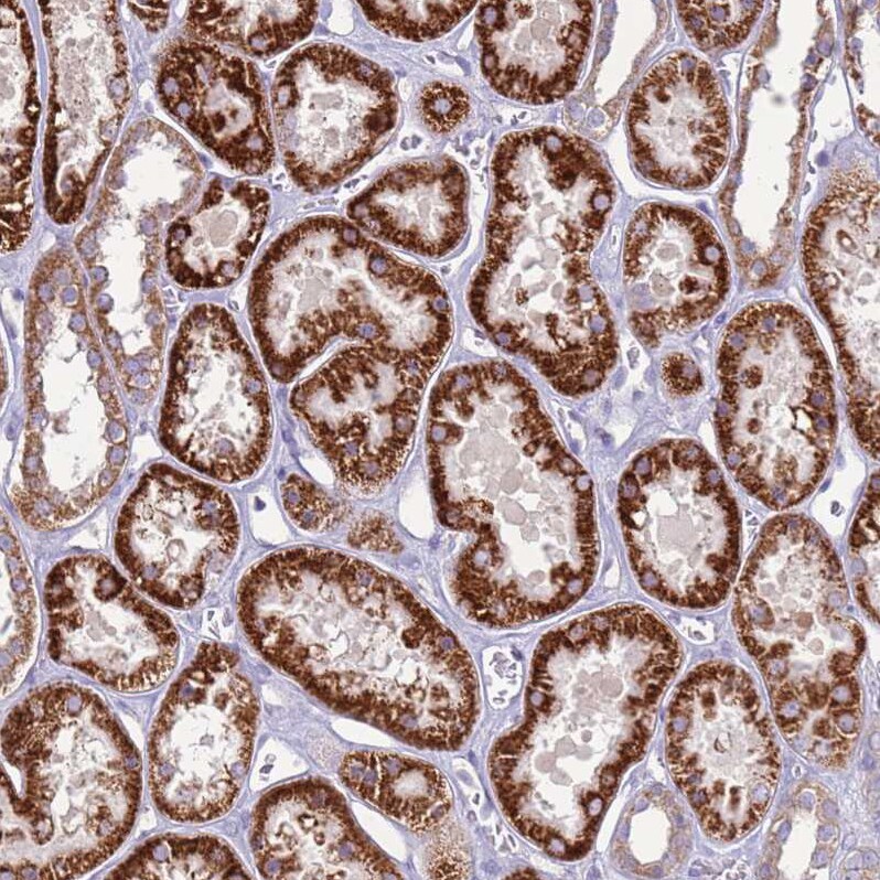 TRAPPC4 Antibody - BSA Free Immunohistochemistry: TRAPPC4 Antibody - BSA Free [NBP2-13476]