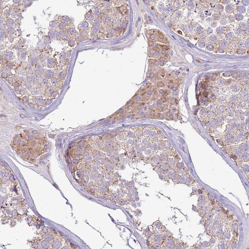 TRAPPC4 Antibody - BSA Free Immunohistochemistry: TRAPPC4 Antibody - BSA Free [NBP2-13476]