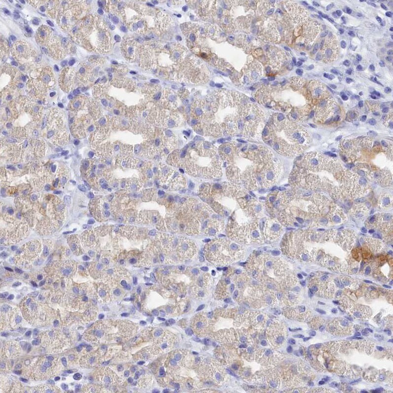 TRIM10 Antibody - BSA Free Immunohistochemistry: TRIM10 Antibody - BSA Free [NBP2-13479]