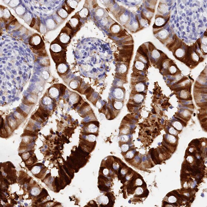 TRIM10 Antibody - BSA Free Immunohistochemistry: TRIM10 Antibody - BSA Free [NBP2-13479]