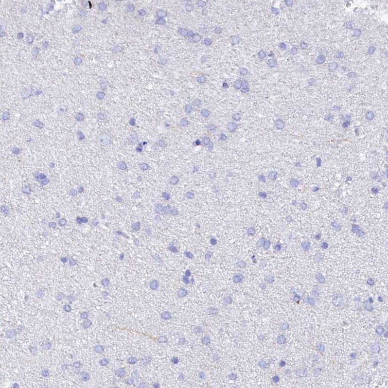 TRIM10 Antibody - BSA Free Immunohistochemistry: TRIM10 Antibody - BSA Free [NBP2-13479]