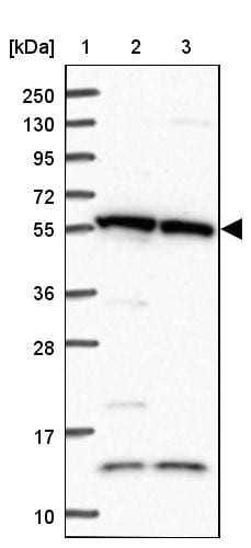 TRIM27 Antibody - BSA Free Western Blot: TRIM27 Antibody - BSA Free [NBP2-13482]