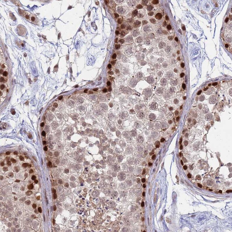 CGI-09 Antibody - BSA Free Immunohistochemistry: CGI-09 Antibody - BSA Free [NBP2-13486]