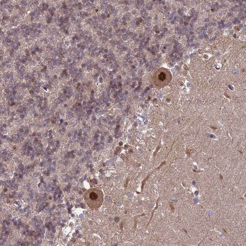CGI-09 Antibody - BSA Free Immunohistochemistry: CGI-09 Antibody - BSA Free [NBP2-13486]