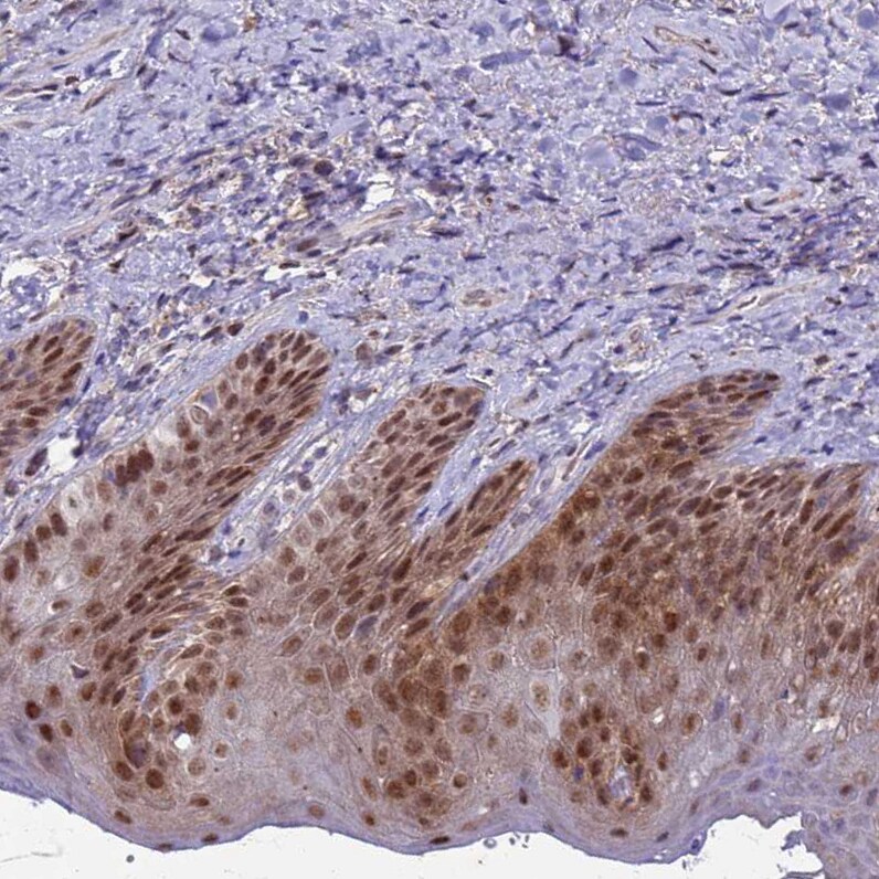 CGI-09 Antibody - BSA Free Immunohistochemistry: CGI-09 Antibody - BSA Free [NBP2-13486]