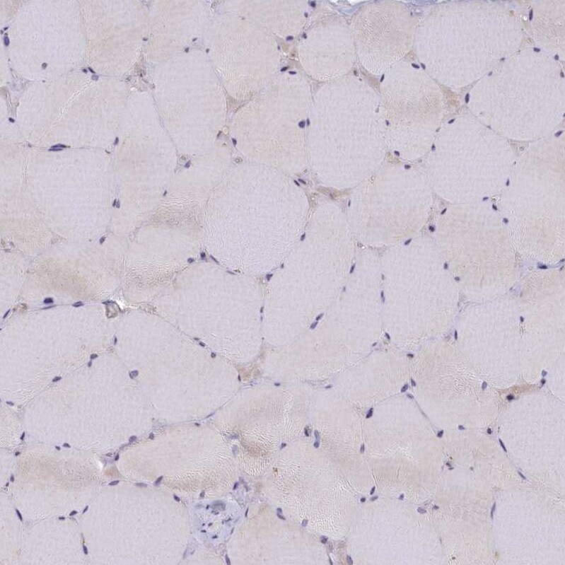 TRPM4 Antibody - BSA Free Immunohistochemistry: TRPM4 Antibody - BSA Free [NBP2-13487]