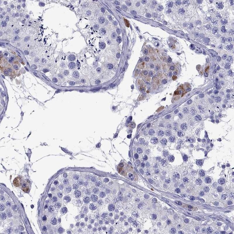 TTLL13 Antibody - BSA Free Immunohistochemistry-Paraffin: TTLL13 Antibody [NBP2-13492]
